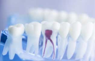 Endodonzia